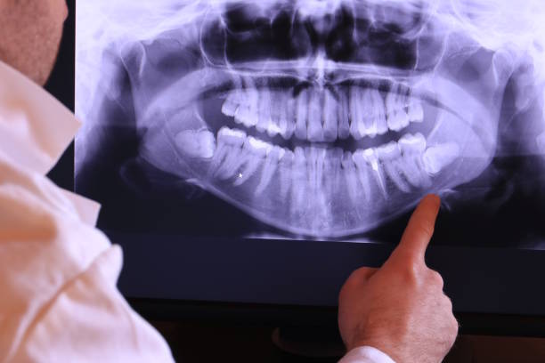 Best Emergency Treatment for Dental Infections or Abscesses in Hidden Valley, IN